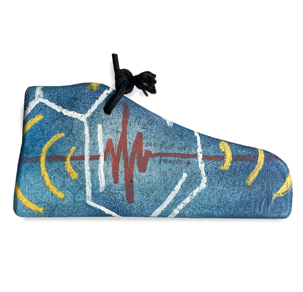 EKG